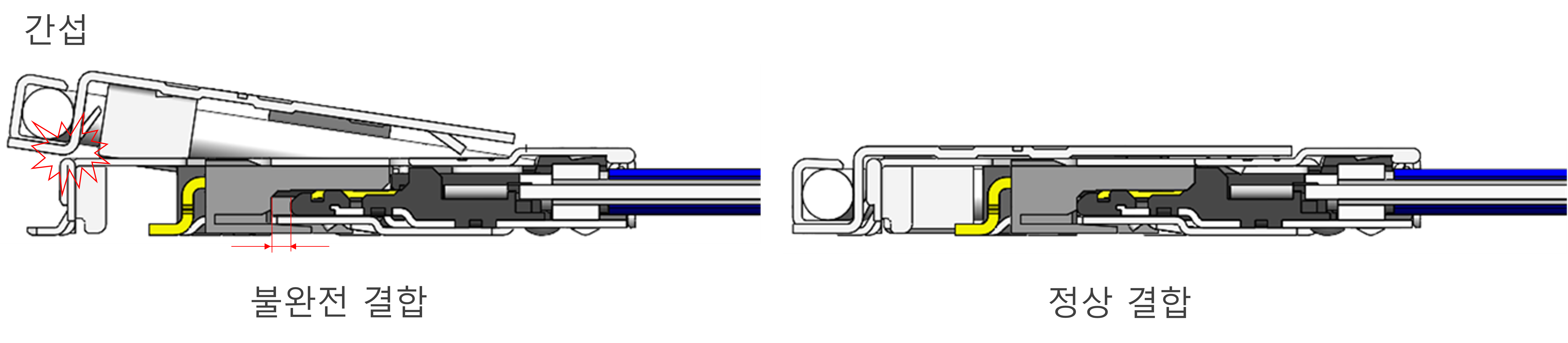 불완전 결합, 정상 결합